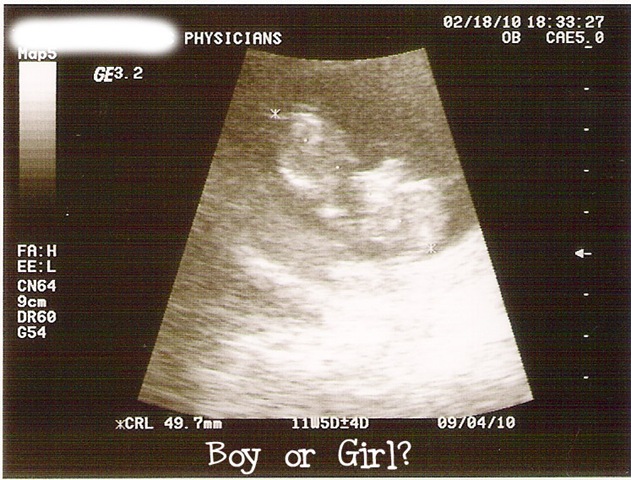 [little_girl_15.jpg]