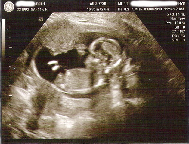 [baby_1[4].jpg]