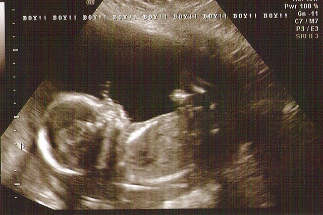 [20weeks[5].jpg]