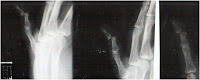 xray 5-23-08 xray 5-23-08