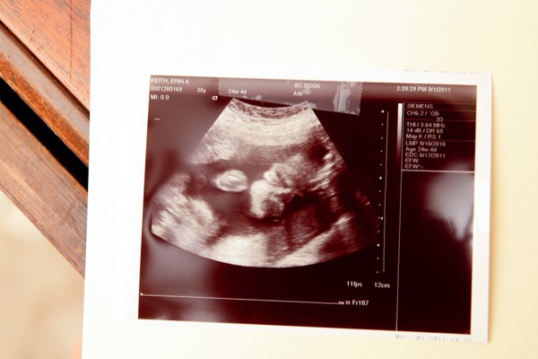 Baby 1