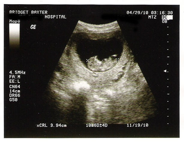 [00baby6[6].jpg]