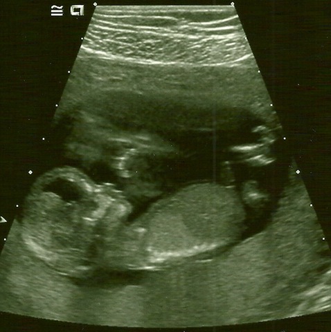 [scan0001[2].jpg]