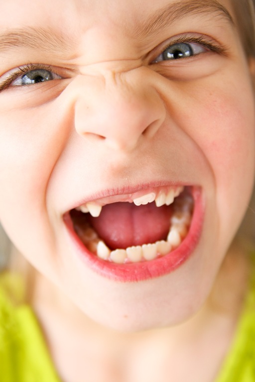 [Morgans front tooth-9298[5].jpg]