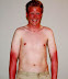 Sunburn - What could this guy possibly be laughing at?