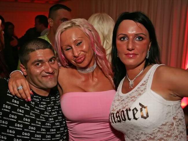 celebrity plastic surgery gone wrong