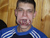 Swallowed glass (part 2) - He's gonna end up in hospital...