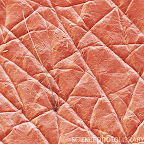 Skin surface. Coloured scanning electron micrograph (SEM) of the pattern seen on the skin of the lower arm and hand. This skin is taken from a 40-year-old man. The outer layer of the skin, the stratum corneum, is made up of dead cells that are constantly shed and replaced by new cells from the epidermis below. Magnification: x30 when printed 10cm wide.