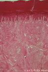 Light micrograph of a section through human skin from the palm of the hand, with sweat glands. The outer layer of skin (top, dark pink), known as epidermis, consists of layers of keratinized, flattened cells. Keratinization is the process whereby the protein keratin is laid down in the cells making them tougher. The sweat gland seen here (lower left) is a simple, coiled tubular gland which is important in thermoregulation (maintenance of a constant body temperature). It secretes a watery fluid on to the skin surface which evaporates & causes cooling of the skin. Magnification: x10 at 35mm size.