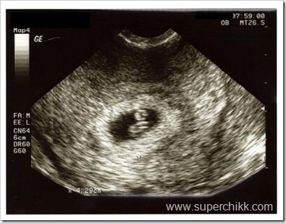 Baby 2, 1st ultrasound pic for blog
