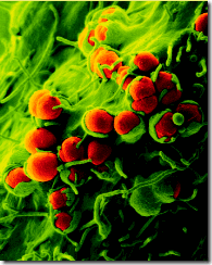 neisseria gonorrea neisseria gonorrea
