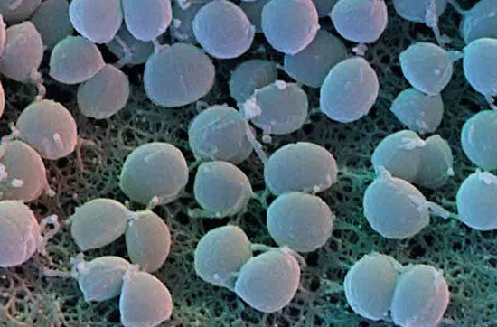 [Methicillin-Resistant Staphylococcus Aureus (MRSA)[2].jpg]