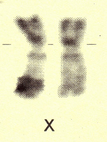 [CromozomX[3].jpg]