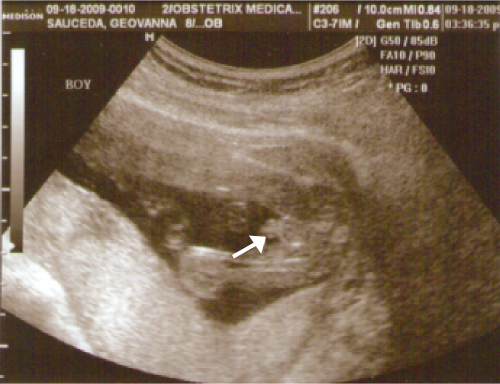 [UltraSound-Sexo[3].png]