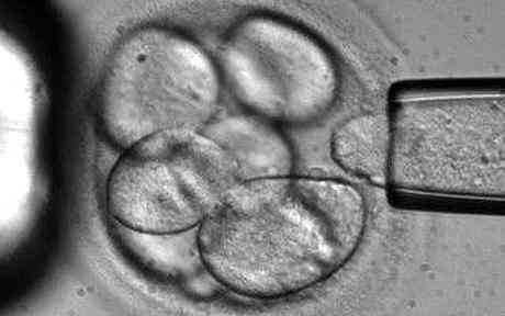 Stem cells could be used to provide mixed sclerosis