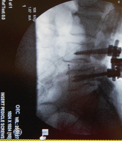 [surgery after[3].jpg]