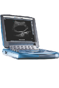 Sonosite Micromaxx