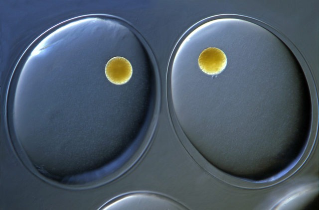 [MicroSnail[3].jpg]