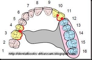 removable partial denture design