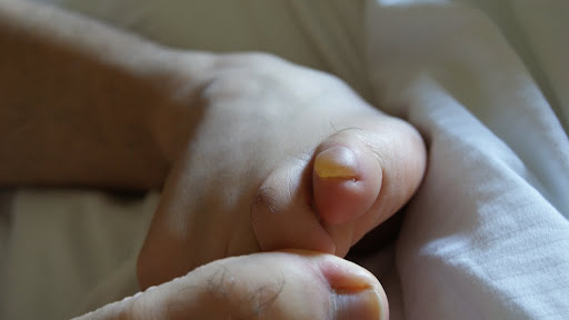 Más ampolla que dedo meñique