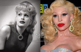 amanda lepore antes y despues de la cirugia plastica