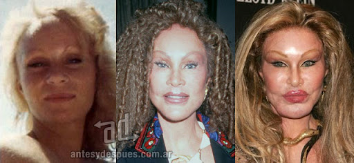 jocelyn wildenstein antes y despues de la cirugia plastica