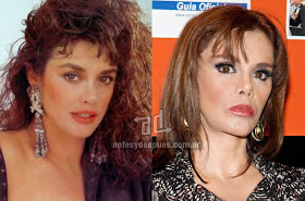 lucia mendez antes y despues de la cirugia plastica