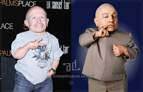 Verne Troyer sin máscara