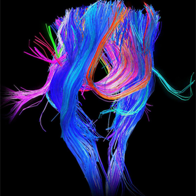 connectoma.jpg