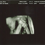 baby_friedman_anatomy_scan_03.jpg