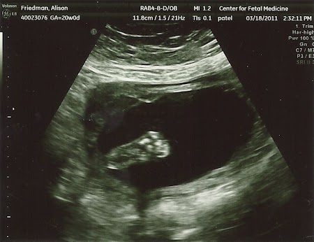 baby_friedman_anatomy_scan_10.jpg