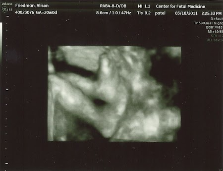 baby_friedman_anatomy_scan_12.jpg