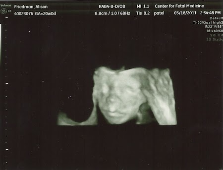 baby_friedman_anatomy_scan_13.jpg