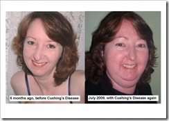 cushing divorced singles personals If you're a single woman over 50, have you ever wondered “what do 50-year-old men want in bed” check out this blog to find out what it’s like dating at 50. cushing divorced singles personals If you're a single woman over 50, have you ever wondered “what do 50-year-old men want in bed” check out this blog to find out what it’s like dating at 50.