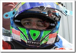 casco