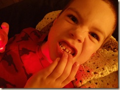 20100831_TravisLost2ndTooth01