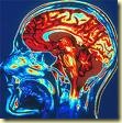 cerebro cerebro
