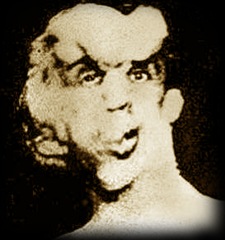 el hombre elefante