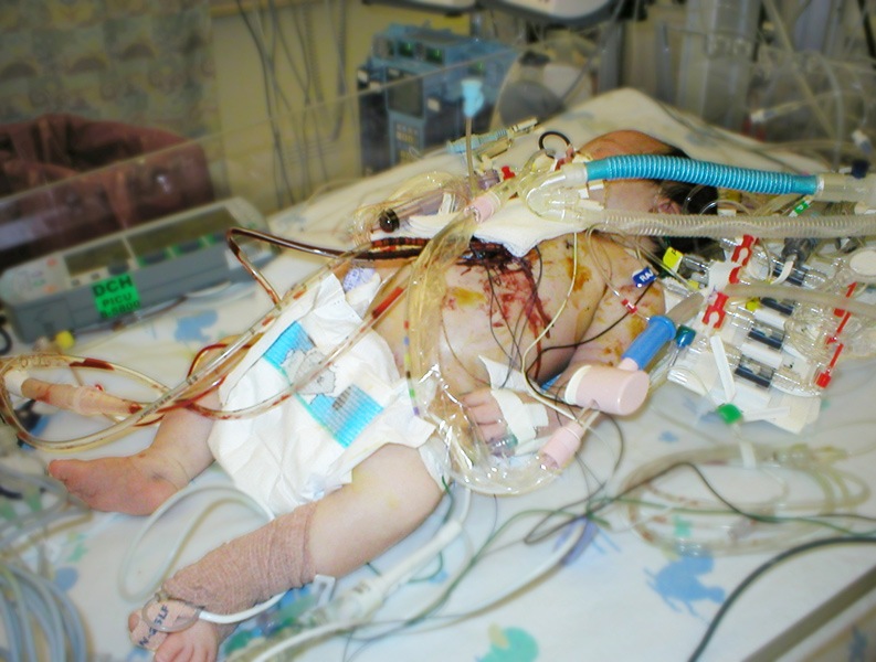 [print_emma_aftersurgery1[5].jpg]