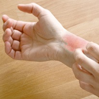 [eczema-main[3].jpg]