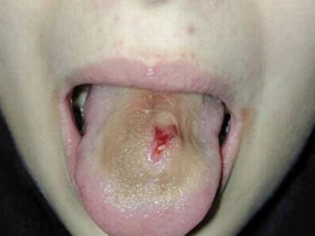 [Piercings&alargadores (35)[3].jpg]