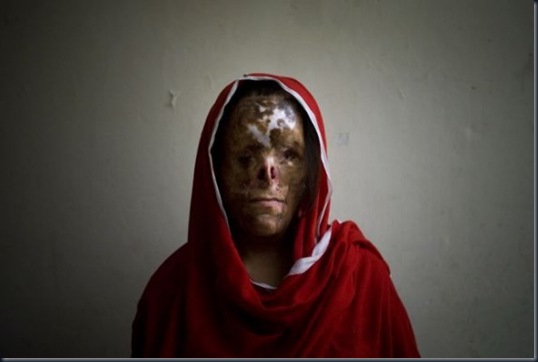acid_terrorism_03-588x391 acid_terrorism_03-588x391