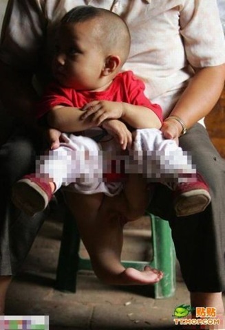 [victims_of_pollution_in_china_06[5].jpg]