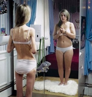 [anorexia[4].jpg]