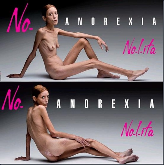anorexia-campanha anorexia-campanha