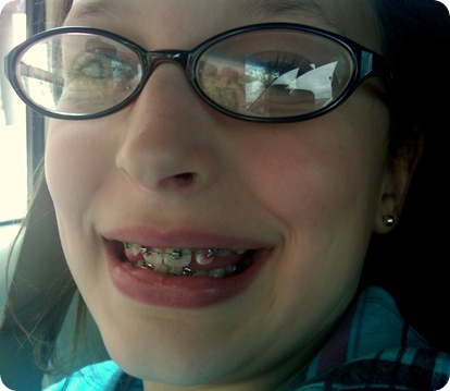 emma braces