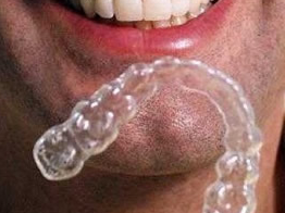 [invisalign[6].png]