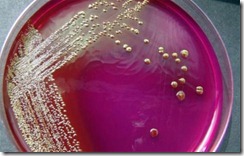 superbacteria-kpc-se-espalha-pelo-pais-794 superbacteria-kpc-se-espalha-pelo-pais-794