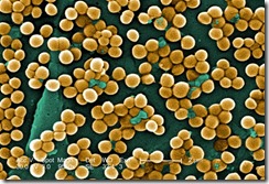 staphylococcus_aureus_electron_microscope