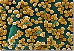 staphylococcus_aureus_electron_microscope staphylococcus_aureus_electron_microscope